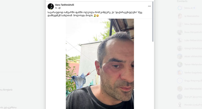 მსახიობ და მომღერალ ვანიკო თარხნიშვილს სცემეს