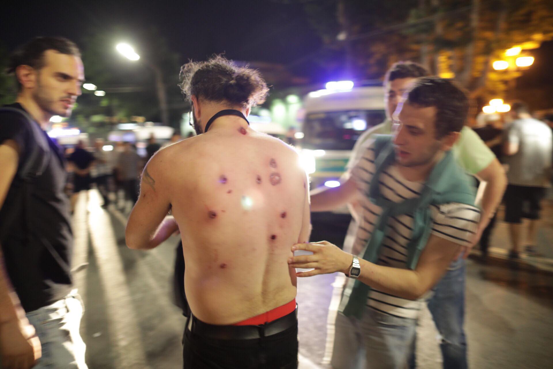 240 Injured During Last Night’s Unrest, Health Ministry Says