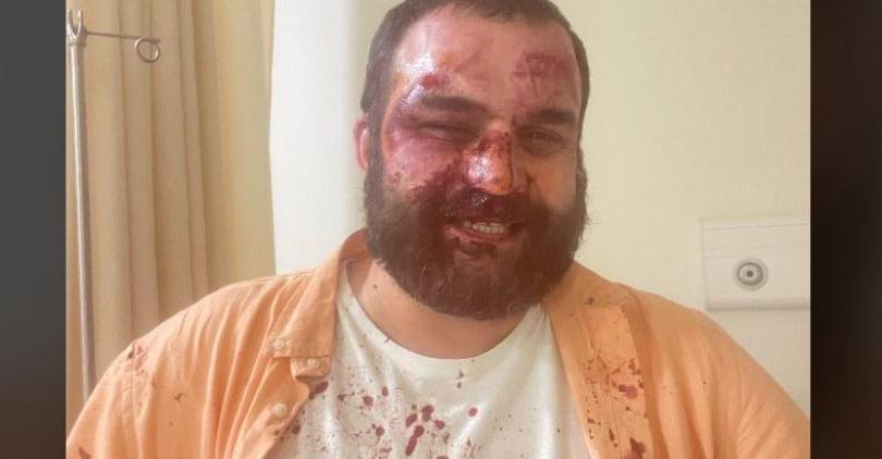 Ombudsman Calls for Law Enforcement Response to May 8 Beatings of Protest Activists