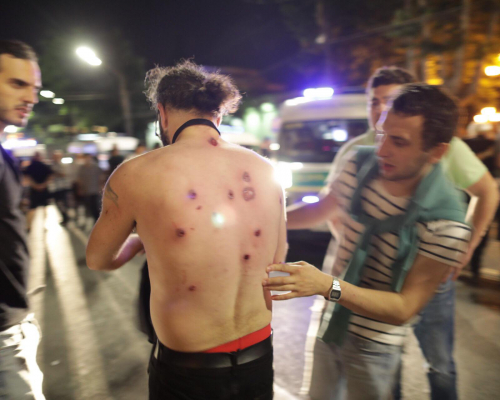 240 Injured During Last Night’s Unrest, Health Ministry Says