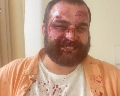 Ombudsman Calls for Law Enforcement Response to May 8 Beatings of Protest Activists
